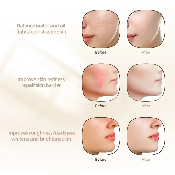 GlowNexa Red Light Therapy Masks US8